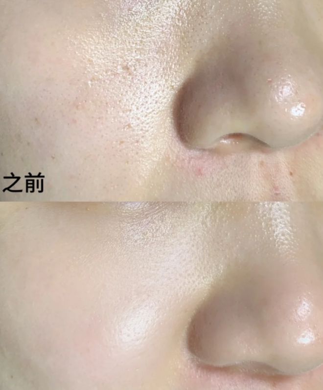 面膜十大平价好用补水面膜推荐！OG视讯国内公认最好用的十大(图6)