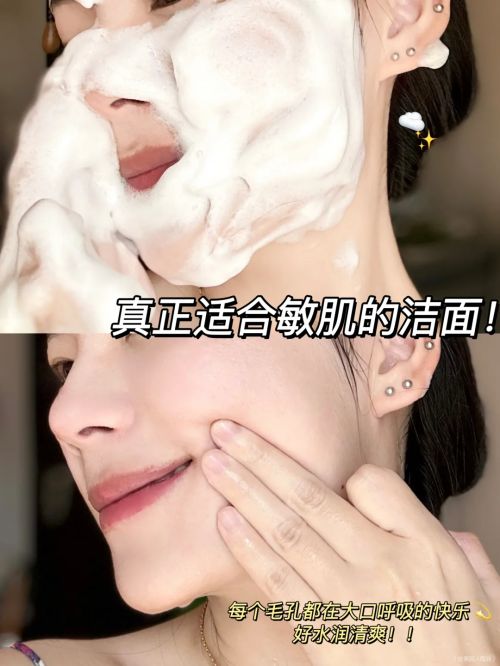 用?男士去痘洗面奶:高口碑爆款OG真人去痘洗面奶哪个牌子最好(图4) 用?男士去痘洗面奶:高口碑爆款OG真人去痘洗面奶哪个牌子最好(图4)